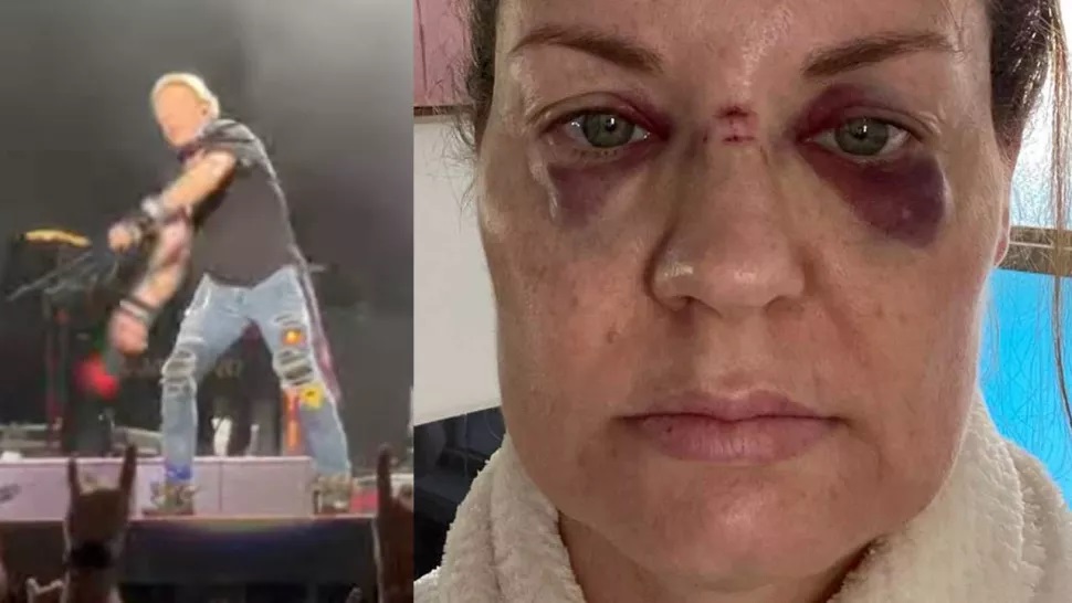 Γυναίκα τραυματίστηκε σοβαρά από το μικρόφωνο που πέταξε ο Axl Rose